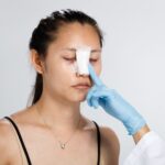 Những lưu ý sau khi thực hiện nâng mũi bán cấu trúc