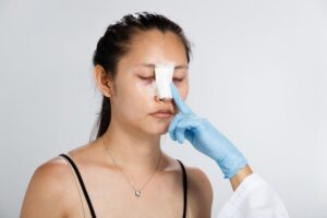 Những lưu ý sau khi thực hiện nâng mũi bán cấu trúc