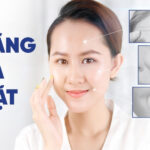 Căng da mặt không phẫu thuật và phẫu thuật - Nên chọn cái nào?