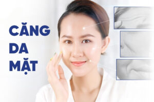 Căng da mặt không phẫu thuật và phẫu thuật - Nên chọn cái nào?