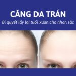 Phẫu thuật căng da trán có đau không? Giá bao nhiêu tiền?