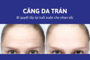 Phẫu thuật căng da trán có đau không? Giá bao nhiêu tiền?