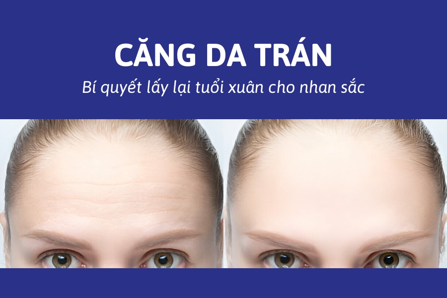 Phẫu thuật căng da trán có đau không? Giá bao nhiêu tiền?