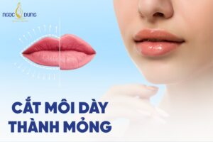 Có nên phẫu thuật thẩm mỹ cắt môi dày thành mỏng không?
