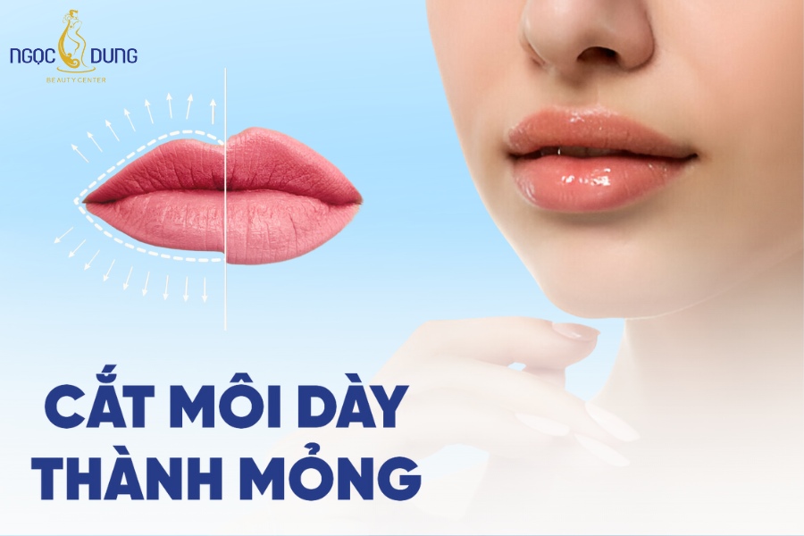 Có nên phẫu thuật thẩm mỹ cắt môi dày thành mỏng không?
