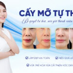 Review cấy mỡ tự thân là gì? Có an toàn không? Giá bao nhiêu?