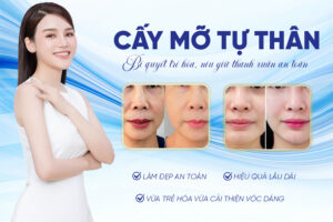 Review cấy mỡ tự thân là gì? Có an toàn không? Giá bao nhiêu?