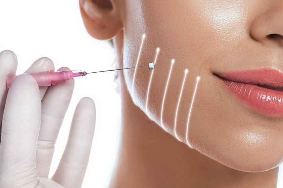 Có nên căng da mặt không?