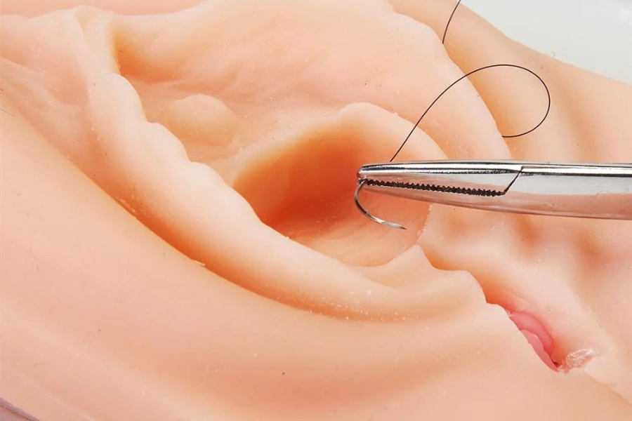 Thu nhỏ tầng sinh môn