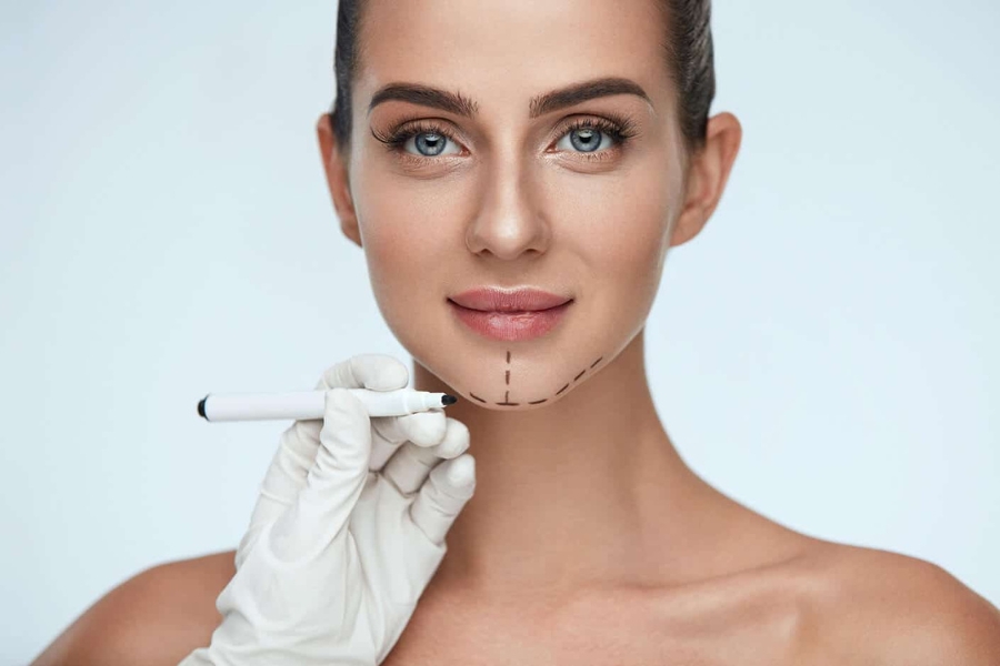 Độn cằm giá bao nhiêu