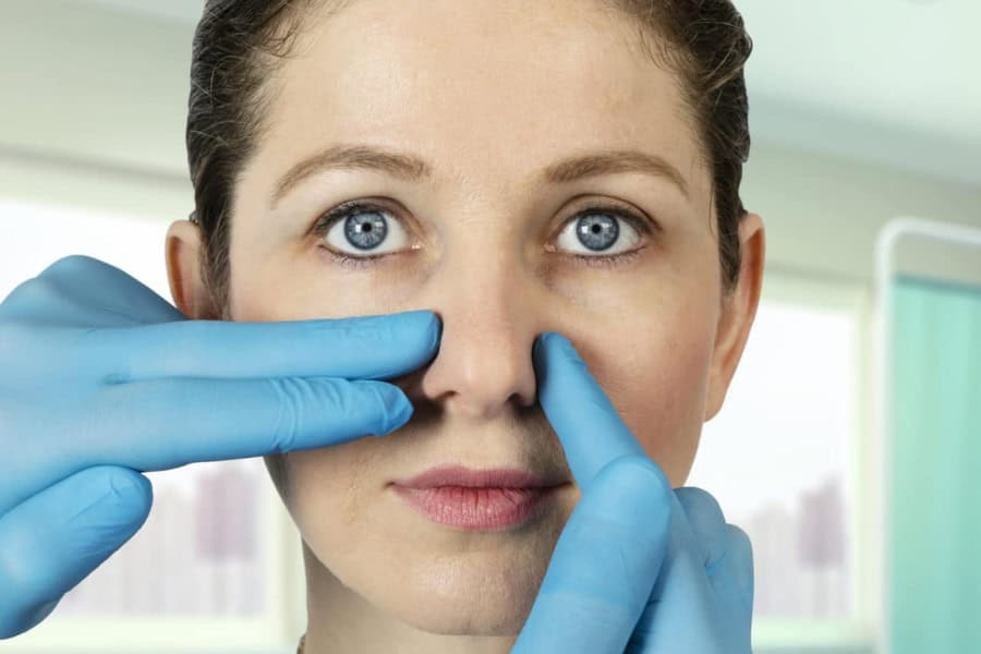 Thu gọn cánh mũi là gì? Giải pháp giúp cho gương mặt hài hòa, tự nhiên 10 Giải đáp chi tiết thu gọn cánh mũi là gì