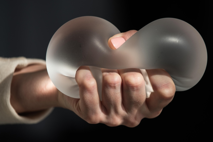 Kết quả nâng mông bằng túi độn duy trì trong bao lâu