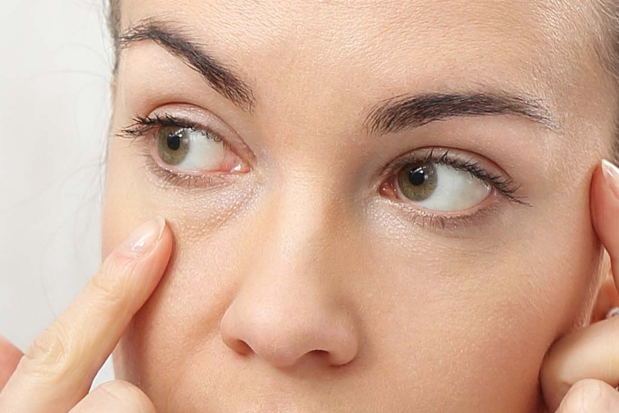 Không đưa tay chạm vào vùng quanh mắt sau khi cắt mắt