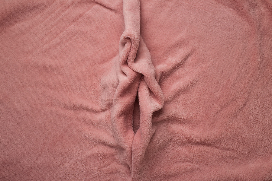 Môi bé bị phì đại, thâm dài gây ảnh hưởng đến “cô bé”