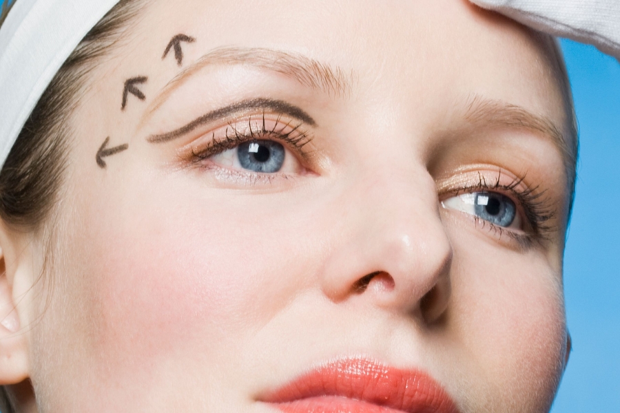 Nâng cung mày trên - Bí quyết "hack tuổi" cho đôi mắt rạng ngời