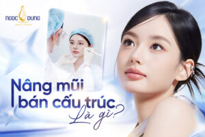 Nâng mũi bán cấu trúc