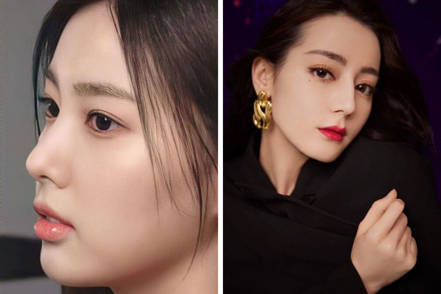 Dáng mũi cấu trúc phổ biến gồm kiểu S-line và L-Line