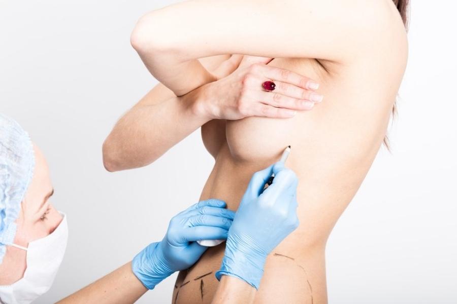 Thăm khám, đo vẽ để lựa chọn phương pháp nâng ngực phù hợp