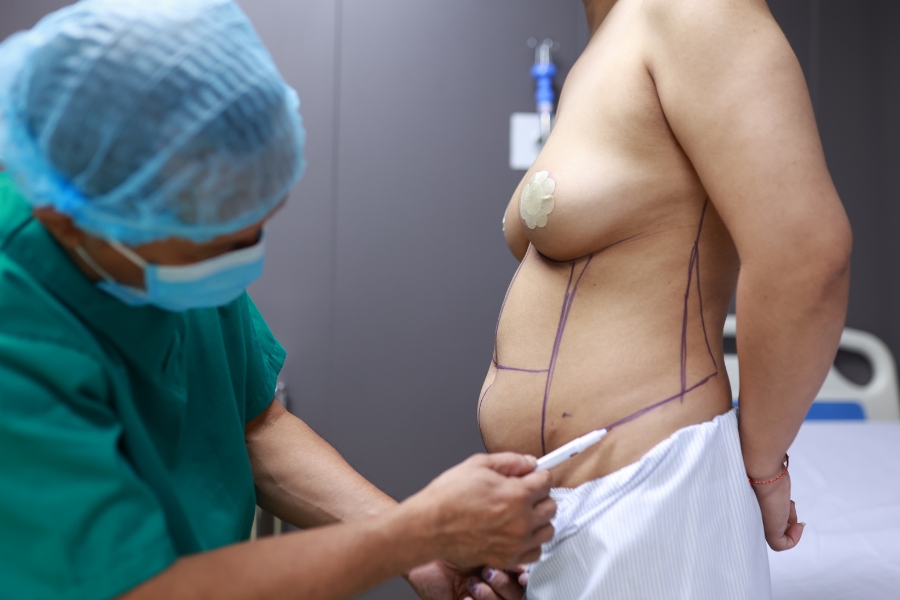 Bác sĩ tư vấn và xác định vị trí cấn thực hiện hút mỡ