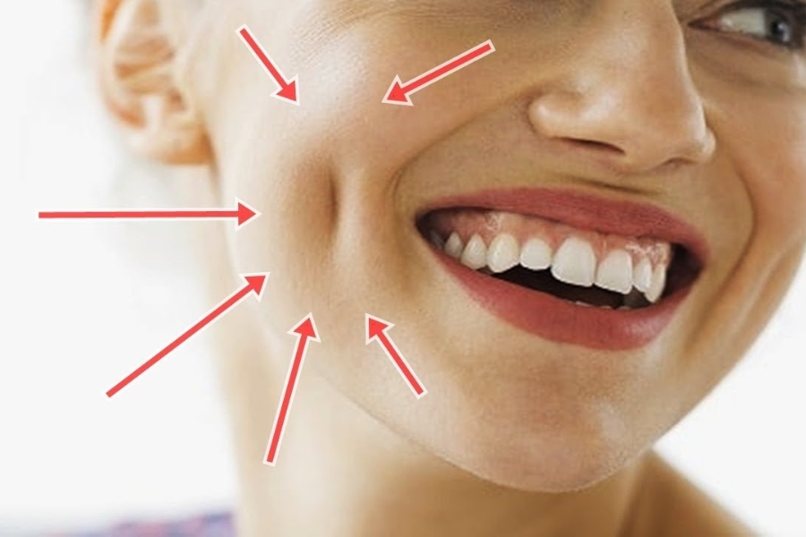 Bạn không cần cắt chỉ sau khâu tạo má lúm đồng tiền đồng điếu