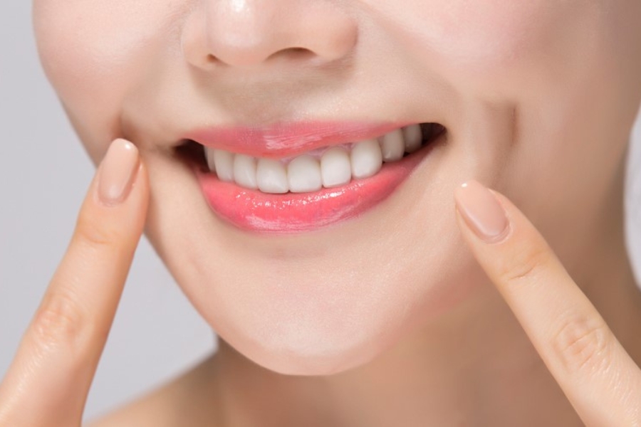 Tạo má lúm đồng tiền không vĩnh viễn, hiệu quả duy trì từ 5-10 năm