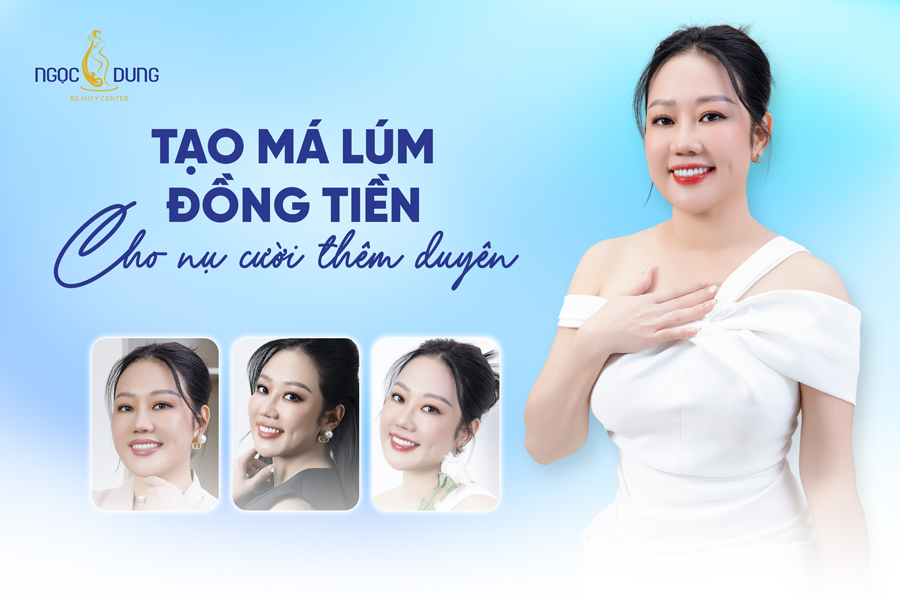 tạo má lúm đồng tiền