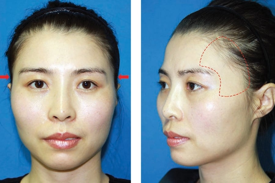 Tầm quan trọng của việc chăm sóc hậu phẫu