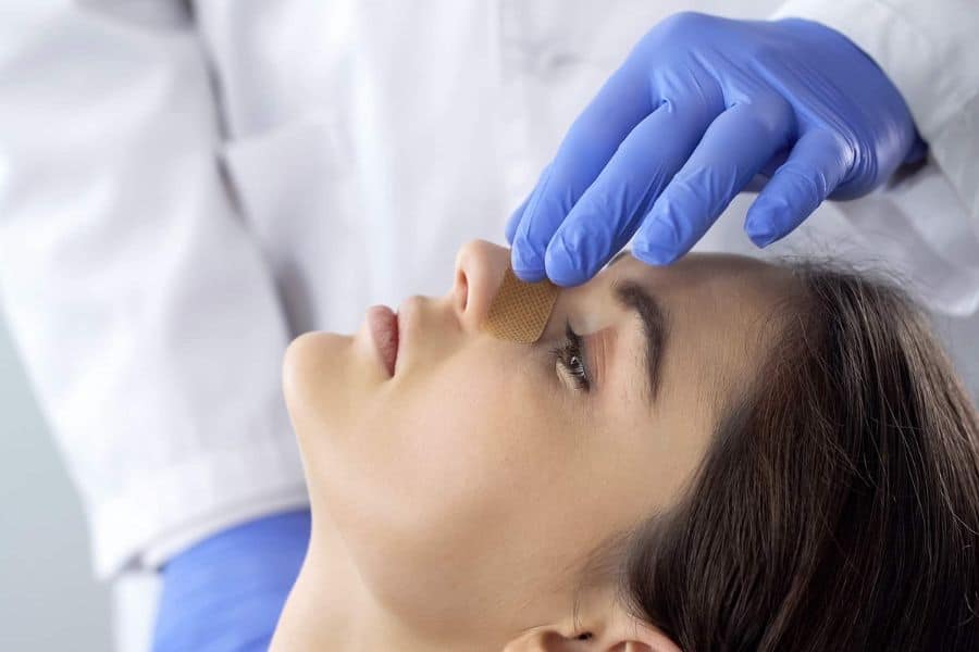 Thu gọn cánh mũi là gì? Giải pháp giúp cho gương mặt hài hòa, tự nhiên 14 word image 2234 6