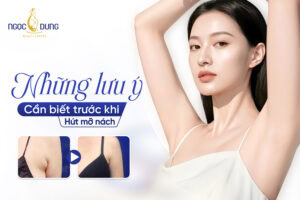 Những lưu ý trước khi hút mỡ nách