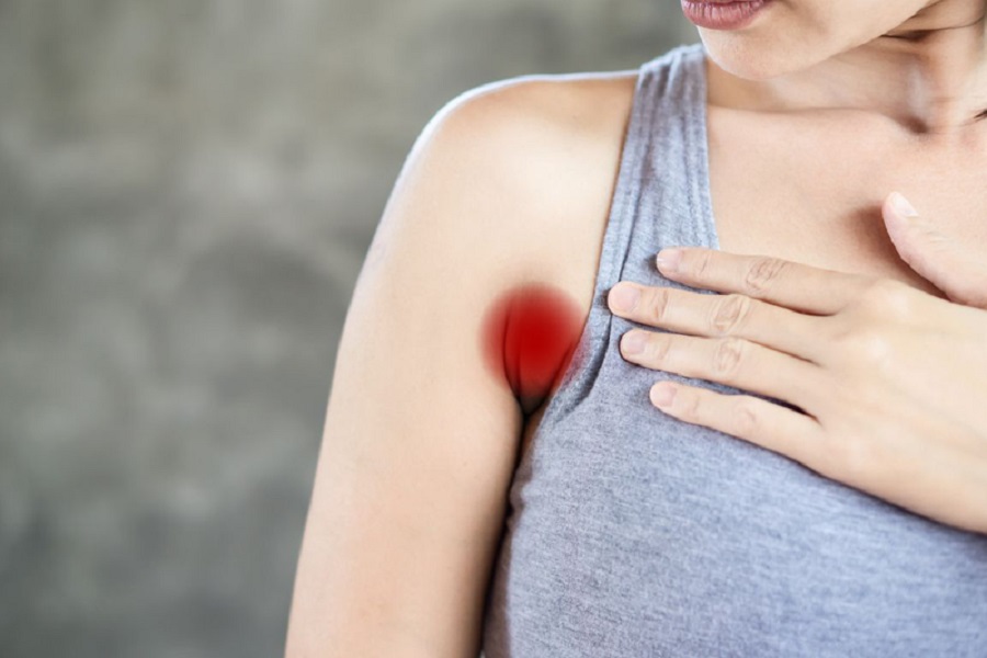 nách bị sưng tấy, viêm đỏ, thâm chí là nhiễm trùng sau khi phẫu thuật