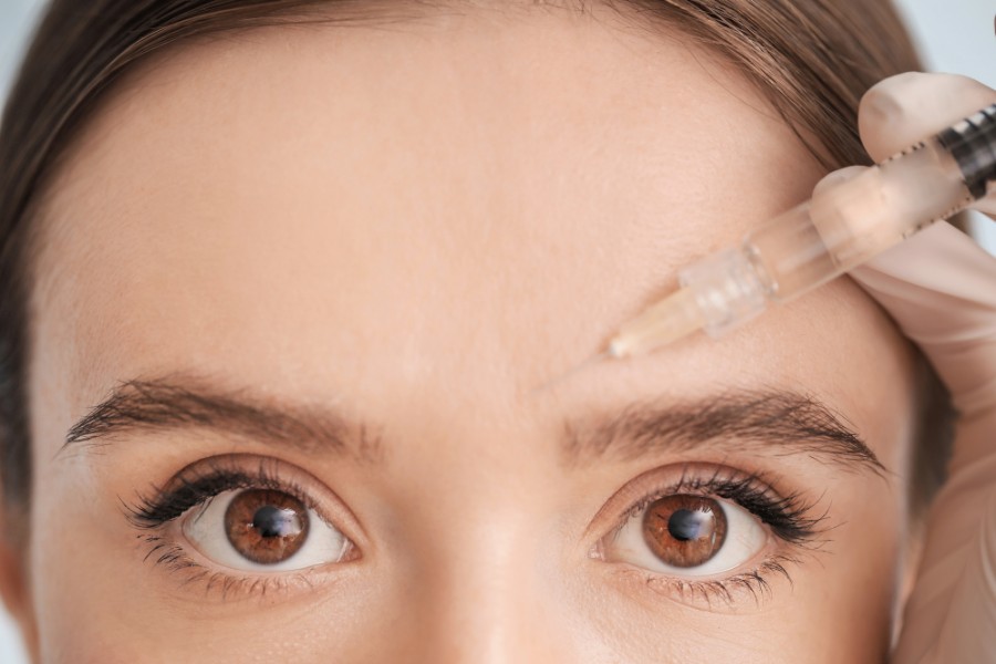 Cấy mỡ tự thân được đánh giá cao hơn so với tiêm filler