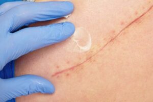 cac ky thuat cat sua seo xau