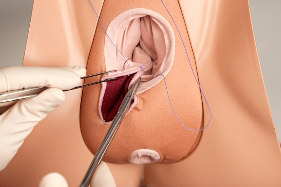 Có 3 phương pháp phục hồi màng trinh phổ biến