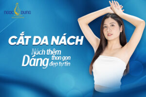 cắt da thừa nách