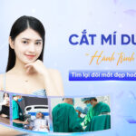Cắt mí dưới - Giải pháp hoàn hảo cho đôi mắt trẻ trung, thu hút