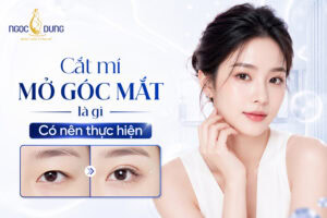 MỞ HỐC MẮT