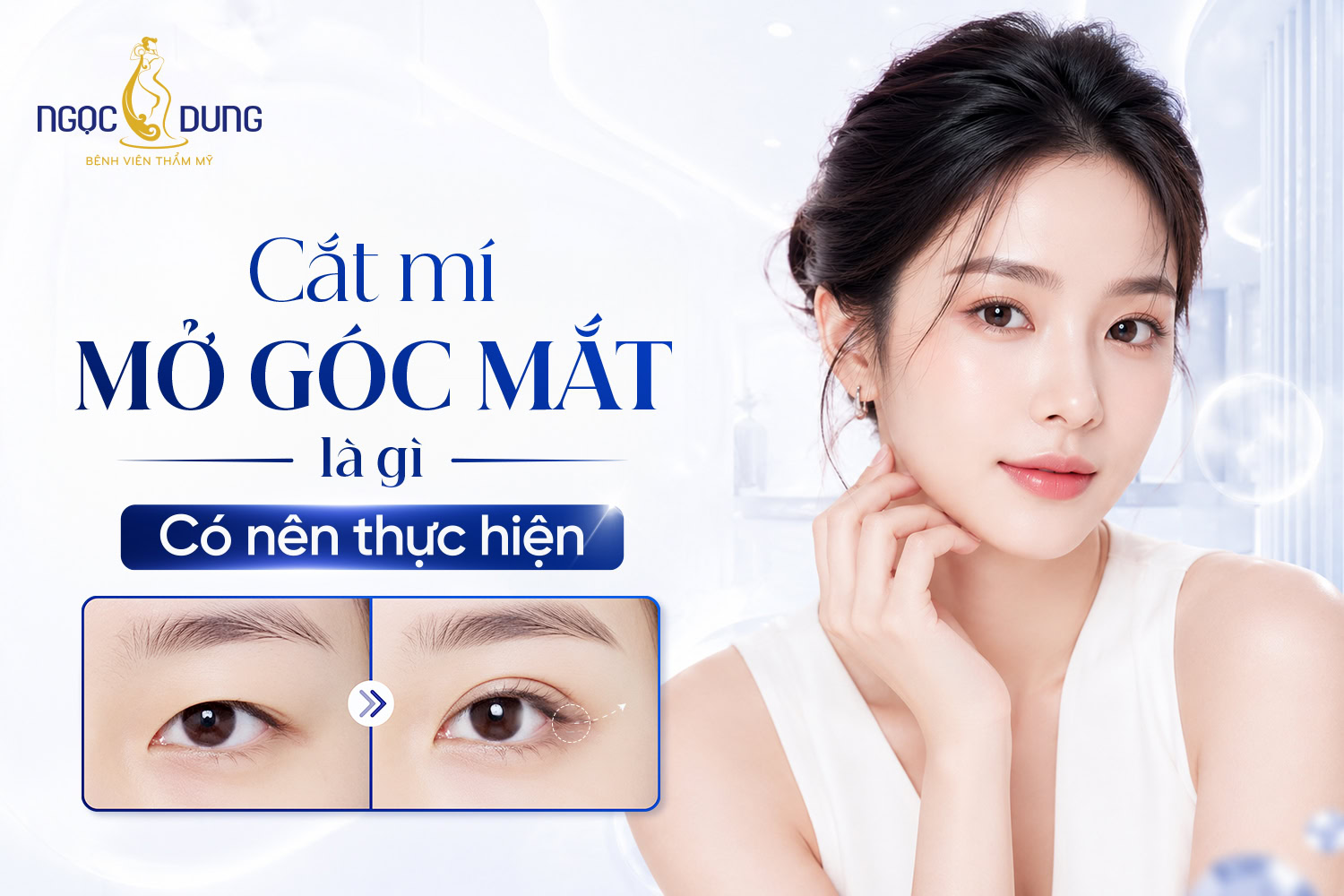 MỞ HỐC MẮT