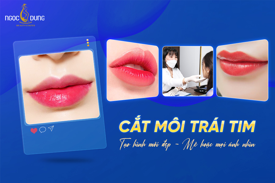 Review có nên cắt môi trái tim không? Tạo hình môi ở đâu đẹp?