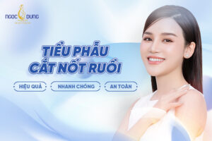 cắt nốt ruồi
