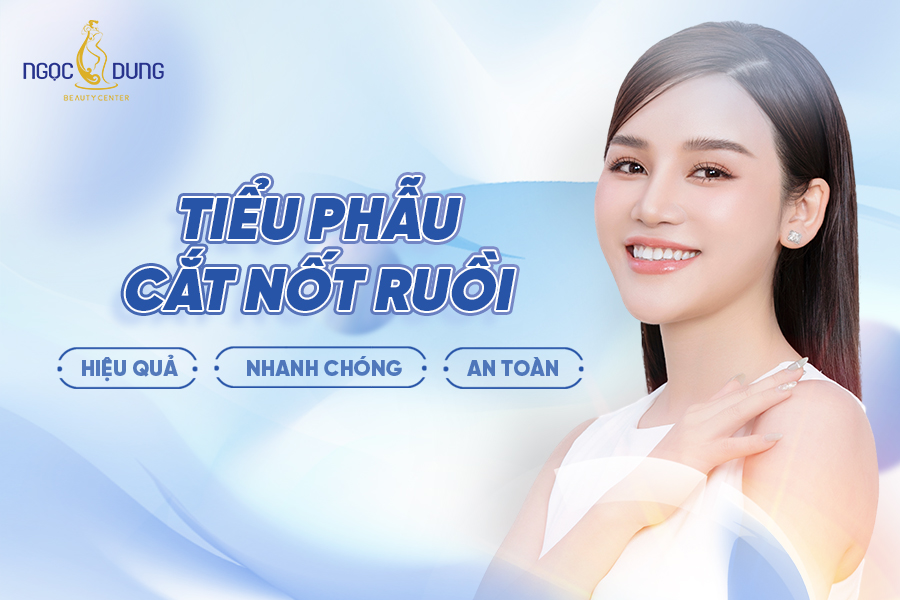 cắt nốt ruồi