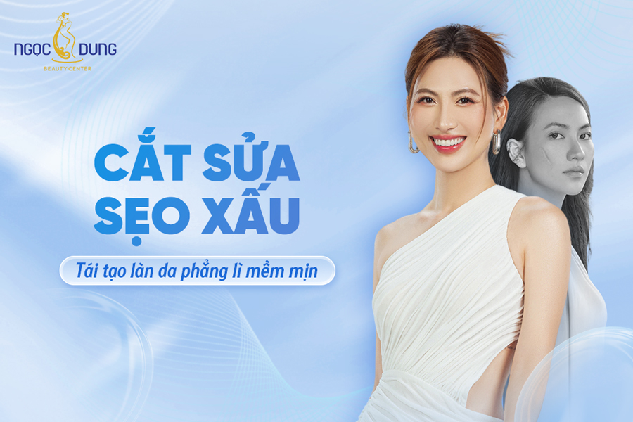 cắt sửa sẹo xấu