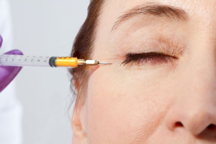 Khoảng từ 7 đến 10 ngày, mỡ được cấy sẽ ổn định như bình thường