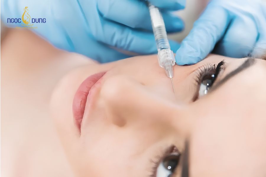 Cấy mỡ tự thân hốc mắt: Chỉ định, quy trình thực hiện và hiệu quả 9 Cấy mỡ hốc mắt là phương pháp giúp đôi mắt tìm lại nét trẻ trung đầy đặn nhanh chóng