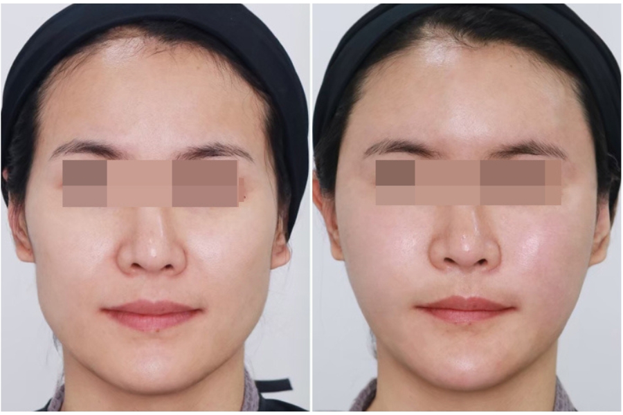 cay mo thai duong eng 4