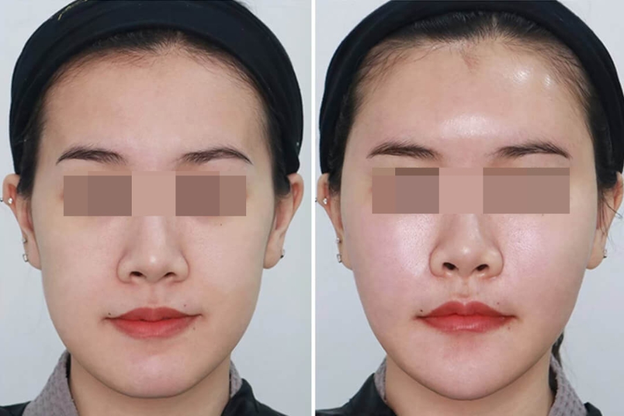 cay mo thai duong eng