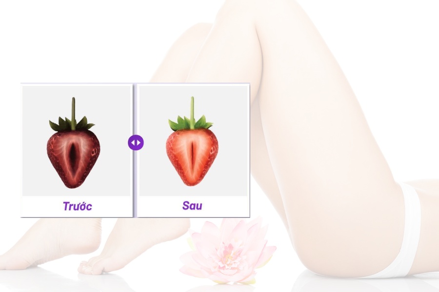 Chi phí làm đầy môi lớn giá bao nhiêu tiền phụ thuộc vào nhiều yếu tố khác nhau