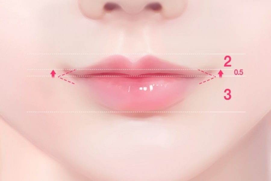 Phương pháp cắt môi - tạo hình môi trái tim có thể kéo dài từ 7-15 năm hoặc có thể hơn