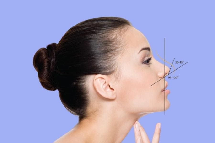 Nâng mũi S line là gì? Tại sao lại được chị em ưa chuộng 10 công nghệ nâng mũi s line