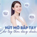 Hút mỡ bắp tay