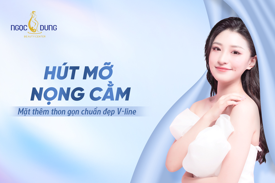 hút mỡ nọng cằm